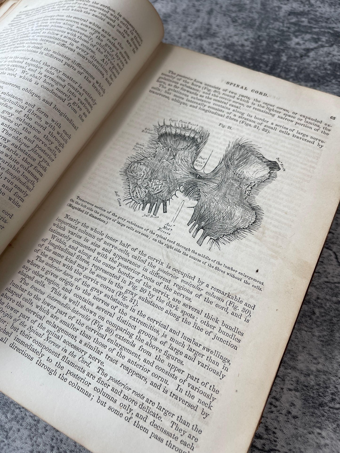 Gray's Anatomy Descriptive and Surgical / Fifth Edition / 1870 - Precious Cache