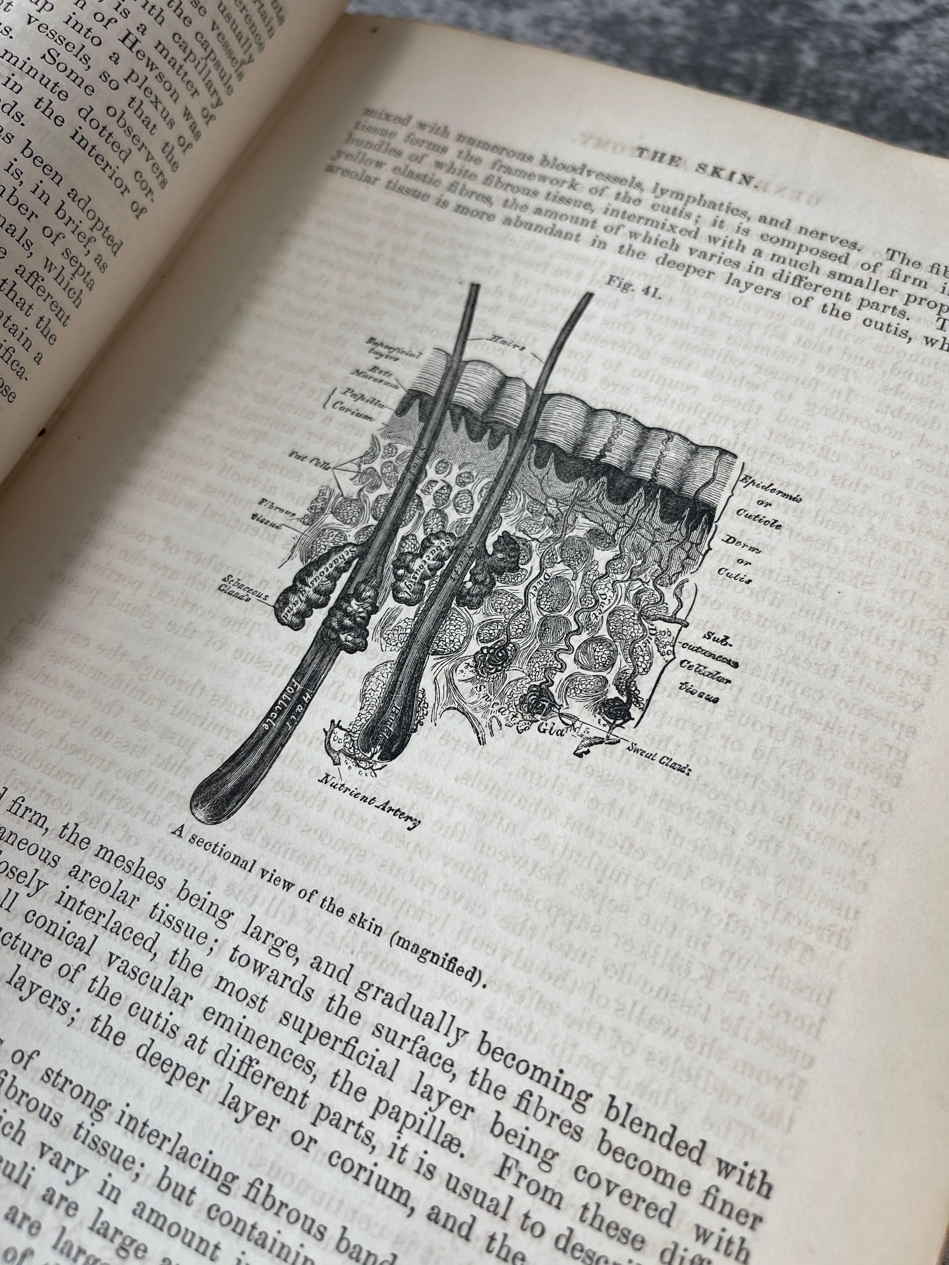 Gray's Anatomy Descriptive and Surgical / Fifth Edition / 1870 - Precious Cache