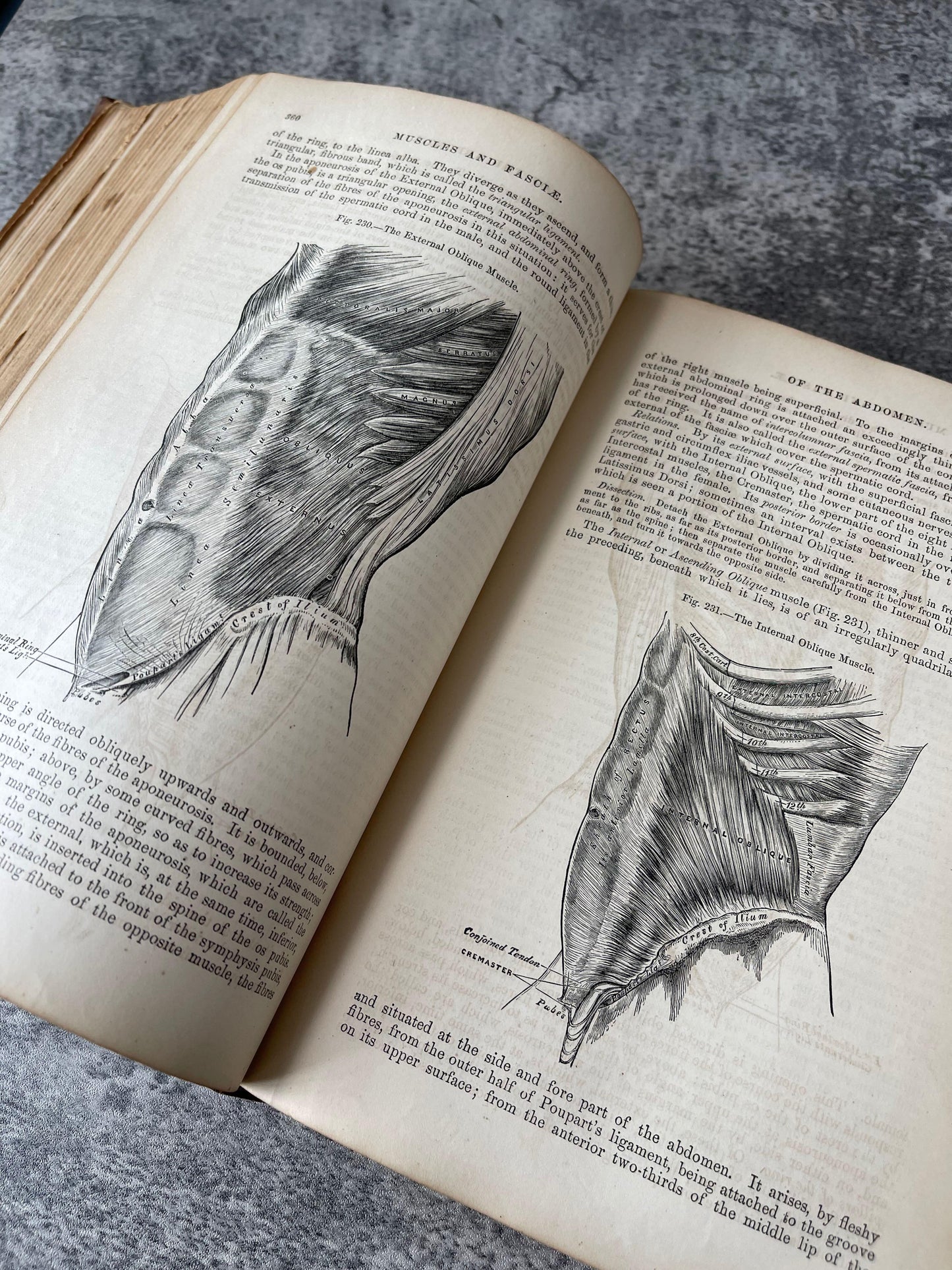 Gray's Anatomy Descriptive and Surgical / Fifth Edition / 1870 - Precious Cache