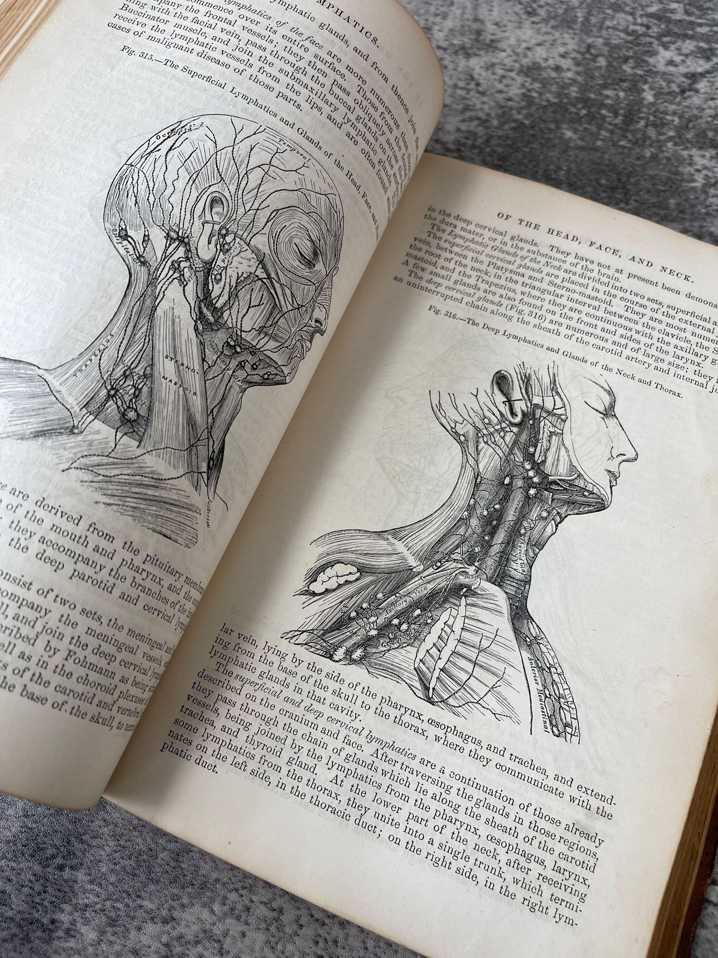 Gray's Anatomy Descriptive and Surgical / Fifth Edition / 1870 - Precious Cache